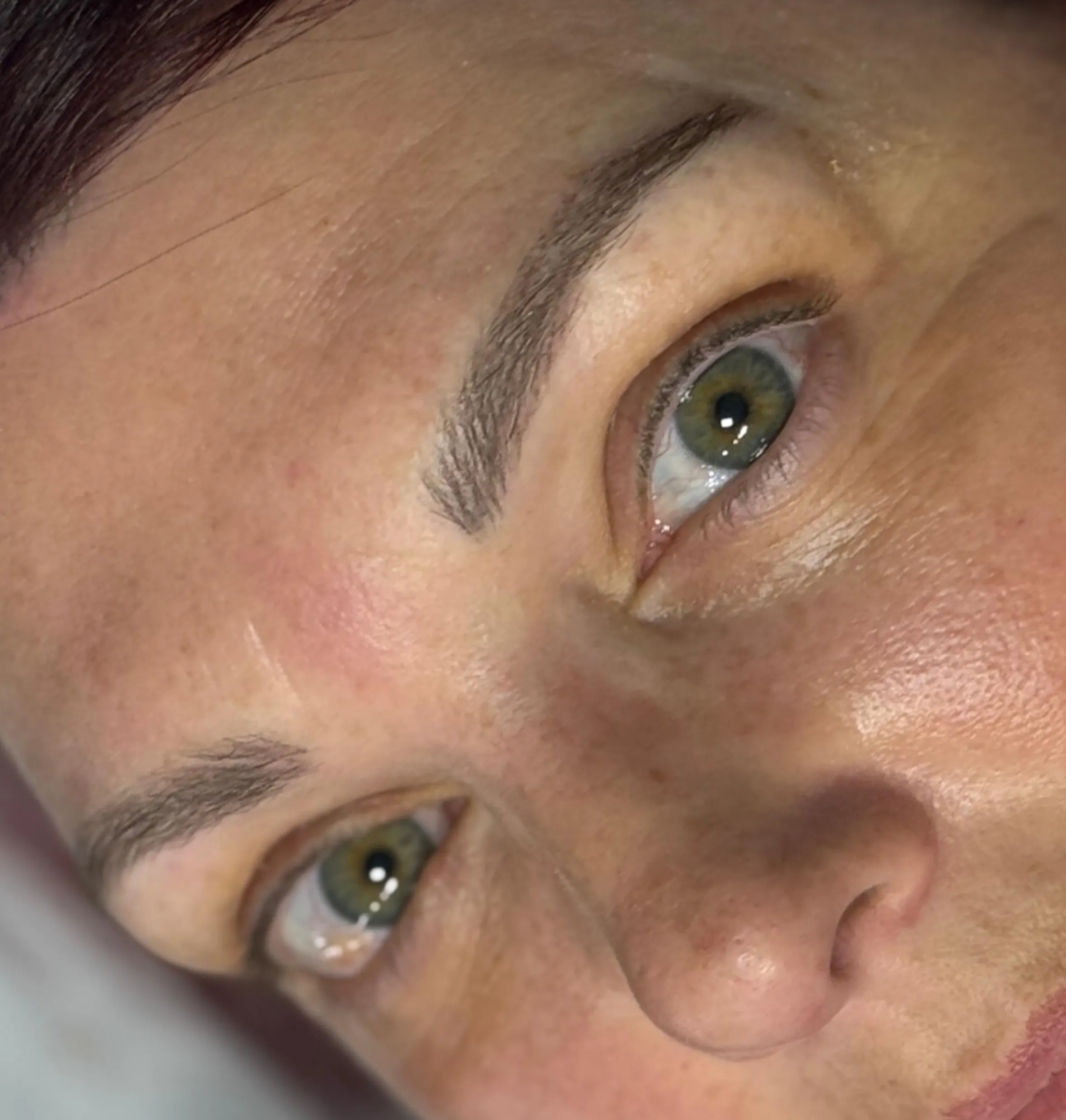 PMU techniques for ageing skin